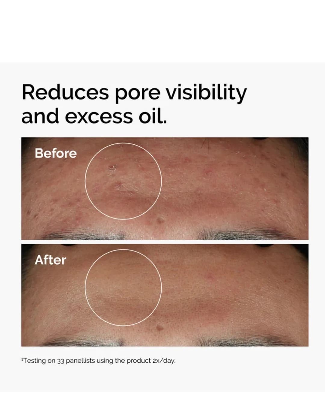 The Ordinary Niacinamide 10% + Zinc 1% 30 ML — photo 3